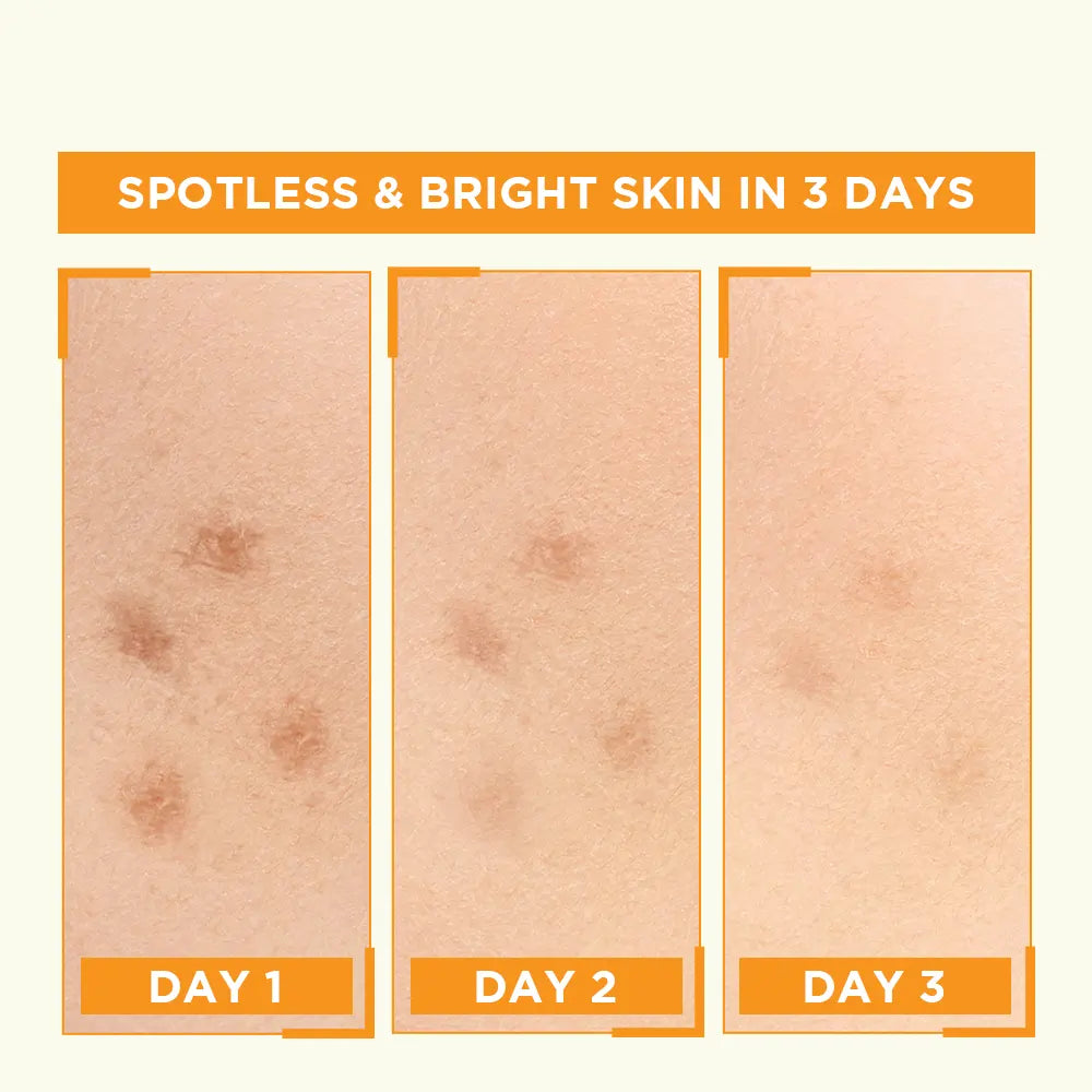 Garnier Bight Complete Vitamin C Booster Serum 30 ml - Contains Niacinamide