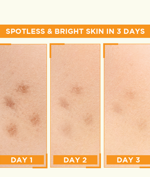 Garnier Bight Complete Vitamin C Booster Serum 30 ml - Contains Niacinamide